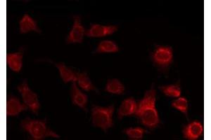 ABIN6269273 staining 293 by IF/ICC. (Tuberin antibody  (Internal Region))