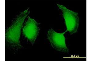 Immunofluorescence of purified MaxPab antibody to OSTF1 on HeLa cell. (OSTF1 antibody  (AA 1-217))