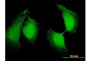 Immunofluorescence of purified MaxPab antibody to OSTF1 on HeLa cell.
