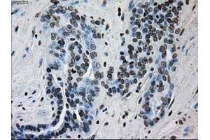 Immunohistochemical staining of paraffin-embedded Kidney tissue using anti-ERCC1 mouse monoclonal antibody.