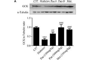 Paeonol upregulated the protein levels of GCK and LDLR and enhanced Akt phosphorylation in animals. (GCK antibody  (AA 1-300))