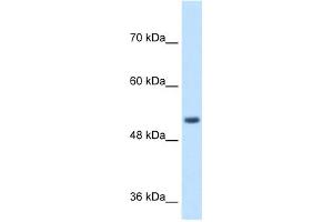 WB Suggested Anti-SPPL2B Antibody Titration:  1 ug/ml  Positive Control:  Jurkat cell lysate SPPL2B is supported by BioGPS gene expression data to be expressed in Jurkat (SPPL2B antibody  (N-Term))