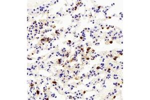 Immunohistochemistry of paraffin embedded mouse lung+LPS using LY6G (ABIN7074524) at dilution of 1:500 (400x lens) (Ly6g antibody)