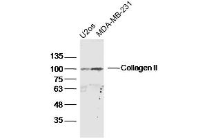Lane 1: U2os lysates Lane 2: MDA-MB-231 lysates probed with Collagen II Polyclonal Antibody, Unconjugated  at 1:300 dilution and 4˚C overnight incubation.