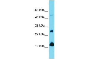 Western Blotting (WB) image for anti-Vesicle-Associated Membrane Protein 1 (Synaptobrevin 1) (VAMP1) (N-Term) antibody (ABIN2789441) (VAMP1 antibody  (N-Term))