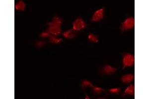 ABIN6272323 staining Hela by IF/ICC. (HOXD8 antibody  (Internal Region))