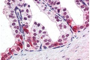 Human Prostate (formalin-fixed, paraffin-embedded) stained with SMARCE1 antibody ABIN351474 at 3. (SMARCE1 antibody  (AA 364-376))