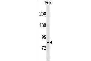 LRCH1 Antibody (Center) (ABIN1881505 and ABIN2839080) western blot analysis in Hela cell line lysates (35 μg/lane). (LRCH1 antibody  (AA 304-333))