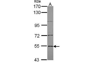 WB Image Sample (30 ug of whole cell lysate) A: A431 , 7. (EDC3 antibody  (Internal Region))