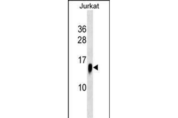 ATP6V1F antibody  (C-Term)