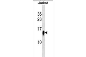 ATP6V1F Antibody (C-term) (ABIN1537610 and ABIN2838177) western blot analysis in Jurkat cell line lysates (35 μg/lane). (ATP6V1F antibody  (C-Term))