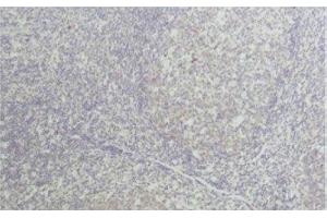 Immunohistochemistry (IHC) image for anti-Tumor Necrosis Factor alpha (TNF alpha) antibody (ABIN7250278)