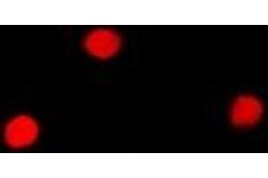 Immunofluorescent analysis of SNRPA staining in Hela cells. (SNRPA1 antibody)
