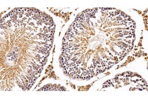 Immunohistochemistry (IHC) image for anti-Interferon alpha (IFNA) antibody (ABIN7429154)