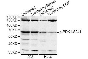 Western blot analysis of extracts of various cell lines, using Phospho-PDK1-S241 antibody (ABIN5995588). (PDPK1 antibody  (pSer241))