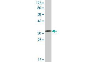 Western Blot detection against Immunogen (36. (CRELD2 antibody  (AA 162-258))