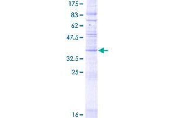 CMTM8 Protein (AA 1-173) (GST tag)