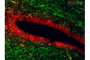 IHC-Fr Image Sox2 antibodies detects Sox2 proteins on embryonic mouse brain by immunohistochemical analysis. (SOX2 antibody)