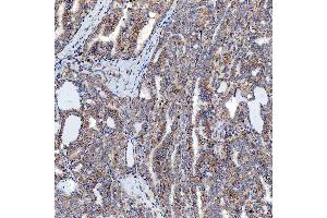 IHC analysis of SFXN5 using anti-SFXN5 antibody (ABIN7601388). (Sideroflexin 5 antibody  (AA 34-340))