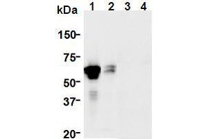 Western Blotting (WB) image for anti-GDNF Family Receptor alpha 1 (GFRA1) (AA 24-440), (Extracellular Domain) antibody (ABIN1449285) (GFRA1 antibody  (Extracellular Domain))