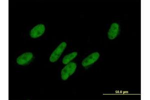Immunofluorescence of purified MaxPab antibody to ZNF777 on HepG2 cell. (ZNF777 antibody  (AA 1-518))