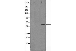 Western blot analysis on Jurkat cell lysate using SPR1 Antibody，The lane on the left is treated with the antigen-specific peptide.
