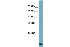 Host:  Rabbit  Target Name:  VPS41  Sample Type:  ACHN Whole Cell lysates  Antibody Dilution:  1.