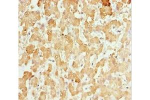 Immunohistochemistry of paraffin-embedded human liver tissue using ABIN7146127 at dilution of 1:100 (CXCL14 antibody  (AA 35-111))