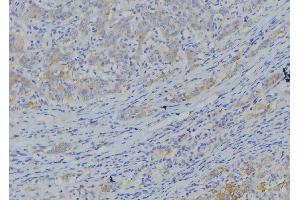 ABIN6273365 at 1/100 staining Human gastric tissue by IHC-P. (NDUFA10 antibody  (C-Term))