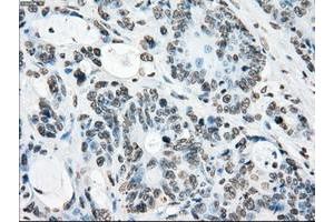 Image no. 11 for anti-P450 (Cytochrome) Oxidoreductase (POR) antibody (ABIN1497746) (POR antibody)