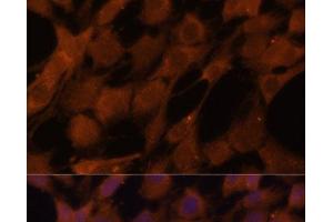 Immunofluorescence analysis of C6 cells using LGMN Polyclonal Antibody at dilution of 1:100 (40x lens). (LGMN antibody)