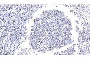 Detection of CD11b in Human Tonsil Tissue using Polyclonal Antibody to Integrin Alpha M (CD11b) (CD11b antibody  (AA 301-451))