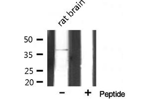Western blot analysis on rat brain lysate using AOS1 Antibody (SAE1 antibody  (Internal Region))