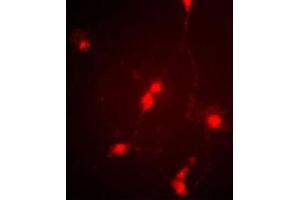 Immunofluorescence image of cultured chick retinal amacrine (neuronal) cells labeled with CLC4 Antibody (C-term) (Cat  f). (CLCN4 antibody  (C-Term))