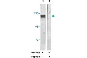 Western blot analysis of extracts from HepG2 cells, treated with Na 2 VO 3  (0. (CBL antibody)