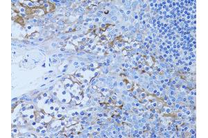 Immunohistochemistry of paraffin-embedded human tonsil using HADH antibody. (HADH antibody)