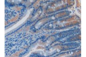 IHC-P analysis of Rat Intestine Tissue, with DAB staining. (PPID antibody  (AA 7-191))