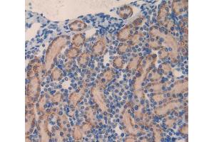 Used in DAB staining on fromalin fixed paraffin- embedded kidney tissue (MMP23A antibody  (AA 71-383))