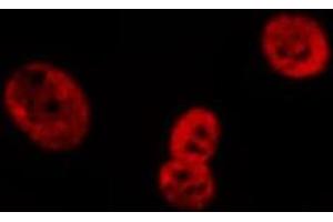 ABIN6269079 staining HeLa cells by IF/ICC. (Lamin A/C antibody  (Internal Region))