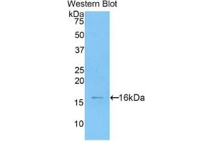 Detection of Recombinant HMGA2, Human using Polyclonal Antibody to High Mobility Group AT Hook Protein 2 (HMGA2) (HMGA2 antibody  (AA 1-109))