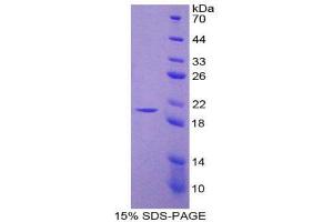 SDS-PAGE (SDS) image for Nitric Oxide Synthase 2, Inducible (NOS2) (AA 530-693) protein (His tag) (ABIN2121776) (NOS2 Protein (AA 530-693) (His tag))