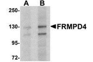 Western blot analysis of FRMPD4 in SK-N-SH cell lysate with AP30349PU-N FRMPD4 antibody at (A) 1 and (B) 2 μg/ml. (FRMPD4 antibody  (Center))