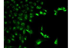 Immunofluorescence analysis of MCF-7 cell using FCGR1A antibody. (FCGR1A antibody  (AA 200-292))