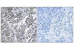 Immunohistochemistry (IHC) image for anti-ATP synthase subunit delta, mitochondrial (ATP5F1D) (Internal Region) antibody (ABIN1850818) (ATP5F1D antibody  (Internal Region))
