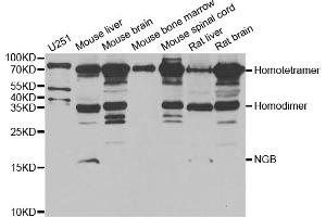 Western blot analysis of extracts of various cell lines, using NGB antibody (ABIN5973872) at 1/1000 dilution. (Neuroglobin antibody)