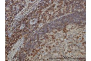 Immunostaining (ISt) image for anti-Differentially Expressed in FDCP 6 Homolog (DEF6) (AA 1-336) antibody (ABIN565491)