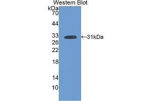 Western Blotting (WB) image for anti-Fms-Related tyrosine Kinase 1 (VEGFR1) (FLT1) (AA 303-524) antibody (ABIN3206008) (FLT1 antibody  (AA 303-524))