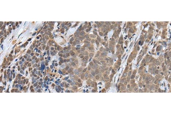 ZNF410 antibody
