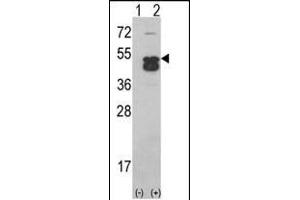 Western blot analysis of CK1D (arrow) using CK1D (CK1 delta)Antibody (C-term) (ABIN391307 and ABIN2841342). (CAMK1D antibody  (C-Term))