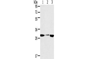 Western Blotting (WB) image for anti-Succinate Dehydrogenase Complex, Subunit B, Iron Sulfur (Ip) (SDHB) antibody (ABIN2433757) (SDHB antibody)